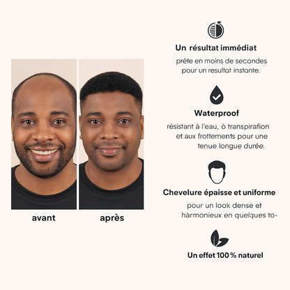 Camouflage Capillaire Professionnel