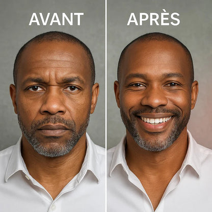 Zooone - Supplément NAD de nicotinamide riboside pour femme et homme